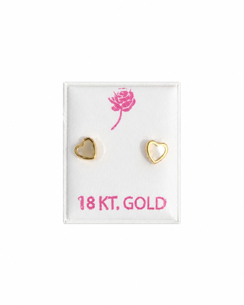Italian 18K Gold Screw-Back Earrings