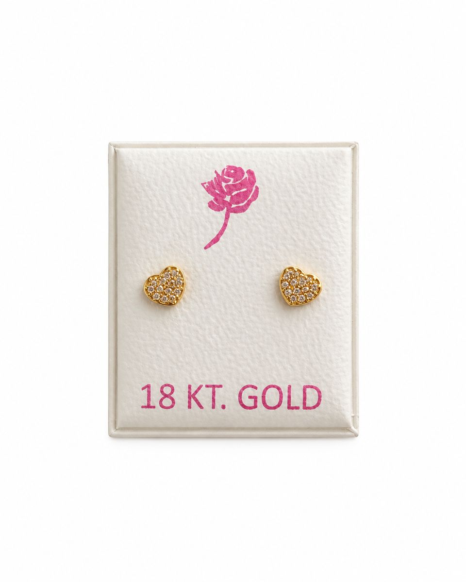 18K Italian Gold Screw-Back Earrings — photo 1 of 2